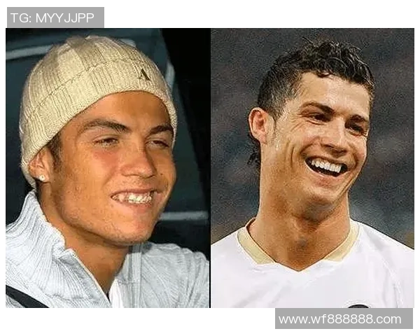 足球明星整容前后对比揭秘全过程及其背后的故事分享 足球明星整容前后对比揭秘全过程及其背后的故事分享